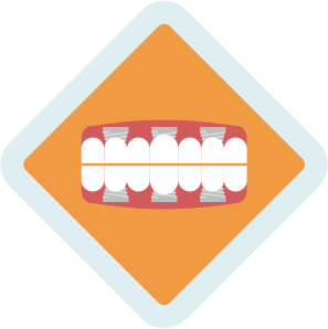 Implant dentures ICON
